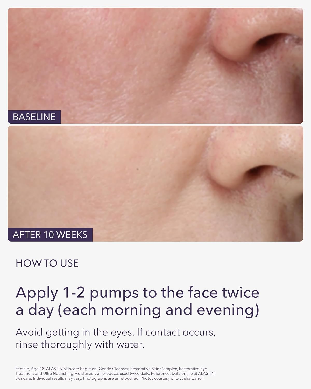 Alastin Restorative Skin Complex serum for smoother, firmer skin before and after results