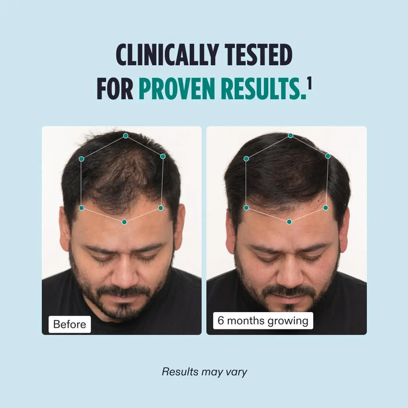 Nutrafol-Men_s-Hair-Growth-Nutraceutical-Dietary-Supplement clinical tested with prove